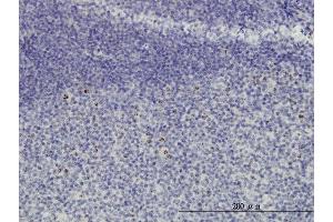 Immunoperoxidase of monoclonal antibody to HSPC111 on formalin-fixed paraffin-embedded human tonsil. (NOP16 antibody  (AA 1-178))