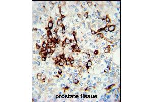 Immunohistochemistry (Paraffin-embedded Sections) (IHC (p)) image for anti-Vimentin (VIM) (AA 152-181) antibody (ABIN389213)