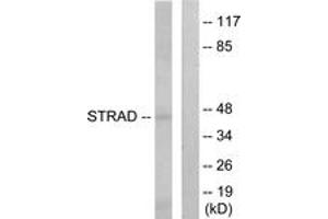 Western blot analysis of extracts from HepG2 cells, using STRAD Antibody. (STRADA antibody  (AA 11-60))