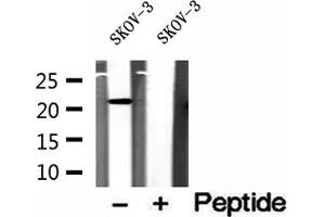 Western blot analysis of extracts of SKOV-3 cells, using ICT1 antibody. (ICT1 antibody)