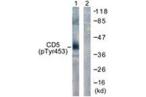 Western blot analysis of extracts from 293 cells treated with PMA 125ng/ml 30' , using CD5 (Phospho-Tyr453) Antibody. (CD5 antibody  (pTyr453))