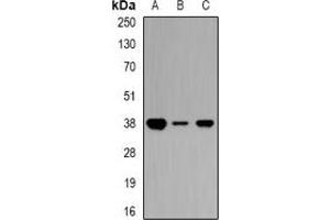 Western blot analysis of Ciao 1 expression in Jurkat (A), mouse kidney (B), rat heart (C) whole cell lysates. (CIAO1 antibody)
