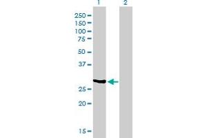 Western Blot analysis of NQO1 expression in transfected 293T cell line by NQO1 monoclonal antibody (M01), clone 1E3-A6.