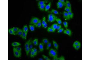 Immunofluorescence staining of HepG2 cells with ABIN7143409 at 1:133, counter-stained with DAPI. (APMAP antibody  (AA 134-240))