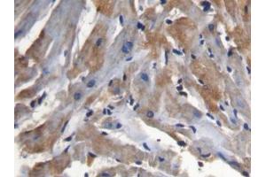 IHC-P analysis of Mouse Cardiac Muscle Tissue, with DAB staining. (SFRP1 antibody  (AA 32-314))
