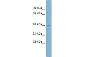 Image no. 1 for anti-NADH Dehydrogenase (Ubiquinone) 1 alpha Subcomplex, 9, 39kDa (NDUFA9) (AA 35-84) antibody (ABIN6742145) (NDUFA9 antibody  (AA 35-84))