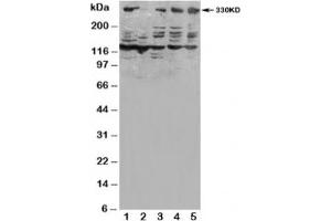 Western blot testing of ATM antibody and Lane 1:  HeLa;  2: SMMC-7721;  3: U87;  4: A549;  5: MCF-7