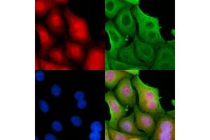 ABIN6260971 and ABIN6278349 staining Hela cells by IF/ICC.