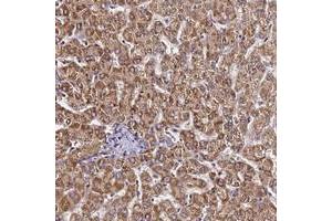 Immunohistochemical staining of human liver with LRRIQ1 polyclonal antibody  shows strong cytoplasmic positivity in hepatocytes. (LRRIQ1 antibody)