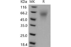 Western Blotting (WB) image for LY6/PLAUR Domain Containing 3 (LYPD3) (Active) protein (His tag) (ABIN7320237) (LYPD3 Protein (His tag))