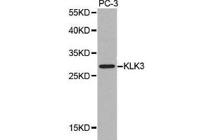 Western blot analysis of extracts of PC-3 cell lines, using KLK3 antibody. (Prostate Specific Antigen antibody  (AA 1-100))