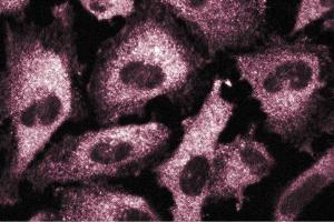 Immunofluorescence staining of human endothelial cells. (CSRP2 antibody  (AA 601-722))