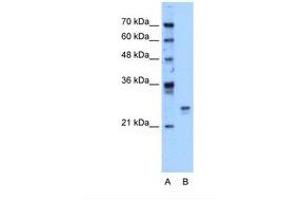 Image no. 1 for anti-High Mobility Group Box 1 (HMGB1) (AA 126-175) antibody (ABIN324443) (HMGB1 antibody  (AA 126-175))