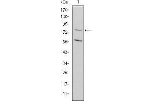 Western blot analysis using MTHFR mouse mAb against Rat Heart cell lysate. (MTHFR antibody)