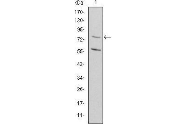 MTHFR antibody