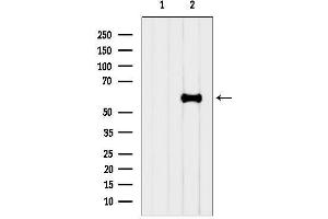 Western blot analysis of lysates from HepG2, using SLC38 Antibody.