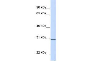 WB Suggested Anti-DCI Antibody Titration:  0. (DCI antibody  (N-Term))