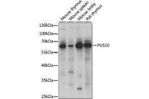 Western blot analysis of extracts of various cell lines, using PUS10 antibody (ABIN7269738) at 1000 dilution. (PUS10 antibody  (AA 290-529))