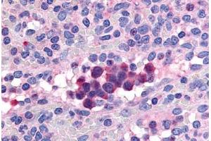 Human Spleen (formalin-fixed, paraffin-embedded) stained with PDE9A antibody ABIN213537 at 20 ug/ml followed by biotinylated goat anti-rabbit IgG secondary antibody ABIN481713, alkaline phosphatase-streptavidin and chromogen. (PDE9A antibody  (Internal Region))