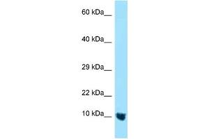 WB Suggested Anti-MTCP1NB Antibody Titration: 1. (CMC4 antibody  (N-Term))