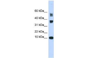 FABP3 antibody used at 1 ug/ml to detect target protein.