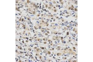 Immunohistochemistry (IHC) image for anti-Small Nuclear Ribonucleoprotein Polypeptide E (SNRPE) antibody (ABIN1876676) (SNRPE antibody)