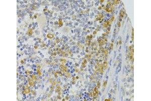 Immunohistochemistry of paraffin-embedded Rat spleen using TRAF3IP2 Polyclonal Antibody at dilution of 1:100 (40x lens). (TRAF3IP2 antibody)