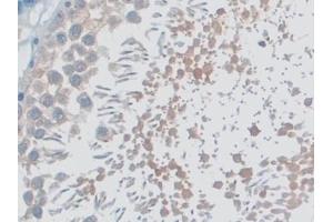 Detection of MYO1D in Rat Testis Tissue using Polyclonal Antibody to Myosin ID (MYO1D) (Myosin ID antibody  (AA 512-788))