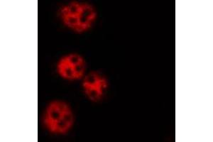 ABIN6269061 staining K562 by IF/ICC. (JAK2 antibody  (N-Term))