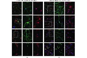 Presence of mature neuronal markers after induction with ICFRYA plus neurotrophic factors and FBS in UCB- and BM-MSCs. (MAPT antibody  (N-Term))