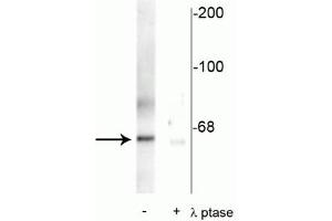 Western blot of rat synaptic membrane showing specific immunolabeling of the ~66 kDa PLK protein phosphorylated at Thr210 in the first lane (-). (PLK1 antibody  (pThr210))