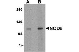 Western blot analysis of NOD5 in rat spleen tissue cell lysate with NOD5 antibody at (A) 1 and (B) 2 μg/ml. (NLRX1 antibody  (N-Term))