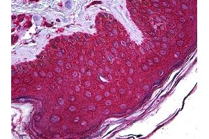 Anti-ABHD5 / CGI-58 antibody IHC of human skin. (ABHD5 antibody  (AA 1-350))