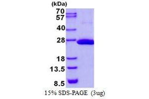 COMM Domain Containing 9 (COMMD9) protein (His tag)