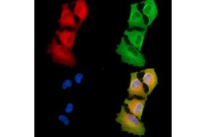 ABIN6264816 and ABIN6279786 staining  cells by IF/ICC.