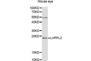 Western blot analysis of extracts of mouse eye, using LHFPL2 antibody (ABIN6294117) at 1:3000 dilution. (LHFPL2 antibody)