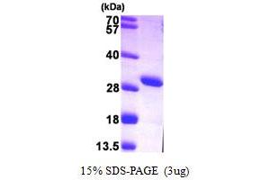 SDS-PAGE (SDS) image for Adenylate Kinase 4 (AK4) (AA 1-223) protein (His tag) (ABIN667331)