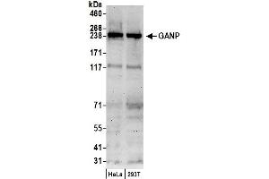 anti-Minichromosome Maintenance Complex Component 3 Associated Protein (MCM3AP) (AA 1-50) antibody
