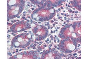 YAP1 antibody was used for immunohistochemistry at a concentration of 4-8 ug/ml. (YAP1 antibody  (C-Term))