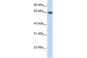 WB Suggested Anti-SLC6A2 Antibody Titration:  0. (SLC6A2 antibody  (Middle Region))