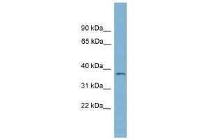 Western Blot showing NUBP1 antibody used at a concentration of 1-2 ug/ml to detect its target protein. (NUBP1 antibody  (Middle Region))