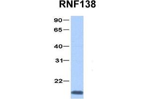 Host:  Rabbit  Target Name:  RNF138  Sample Type:  Jurkat  Antibody Dilution:  1. (RNF138 antibody  (C-Term))