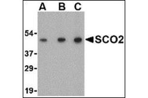 Western blot analysis of SCO2 in human liver tissue lysate with this product at (A) 0. (SCO2 antibody  (C-Term))