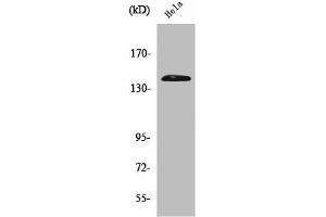 Western Blot analysis of Hela cells using PERK Polyclonal Antibody (PERK antibody  (N-Term))