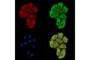 ABIN7097182 and ABIN7101250 staining Hela cells by IF/ICC. (FAM122B antibody)