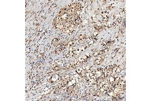 IHC analysis of SNRNP27 using anti-SNRNP27 antibody (ABIN7599614). (SNRNP27 antibody  (AA 100-155))