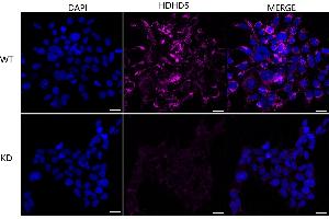 Immunocytochemical staining of HeLa cells using HDHD5 antibody (ABIN7798836), 1:1,000), Top panel: wild-type (WT), Bottom panal: HDHD5 shRNA knockdown (KD).