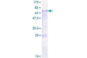 Image no. 1 for PDS5, Regulator of Cohesion Maintenance, Homolog A (PDS5A) (AA 1-333) protein (GST tag) (ABIN1314585) (PDS5A Protein (AA 1-333) (GST tag))