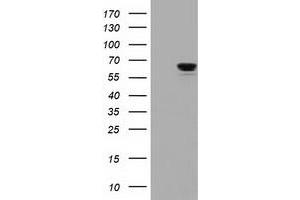 HEK293T cells were transfected with the pCMV6-ENTRY control (Left lane) or pCMV6-ENTRY IGF2BP2 (Right lane) cDNA for 48 hrs and lysed. (IGF2BP2 antibody)