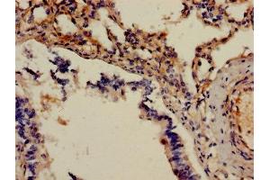 Immunohistochemistry of paraffin-embedded human lung tissue using ABIN7143430 at dilution of 1:100 (Adrenomedullin antibody  (AA 45-92))
